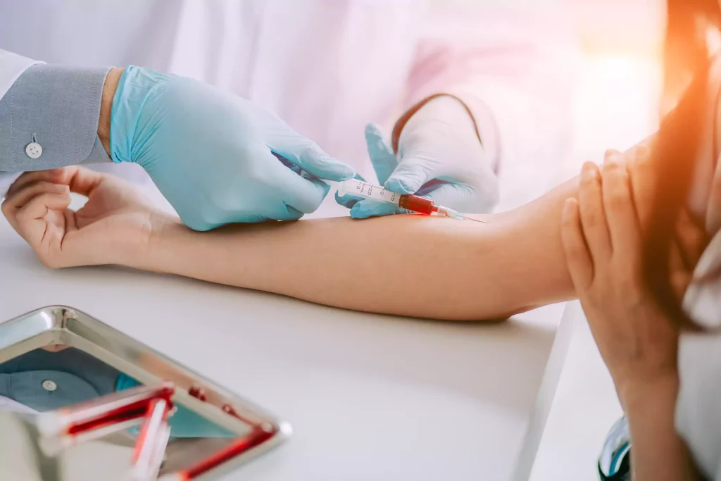 Getting Blood Sample from arms